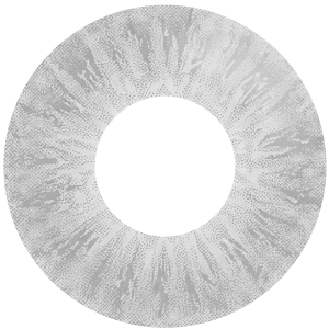 No Limbal Ring